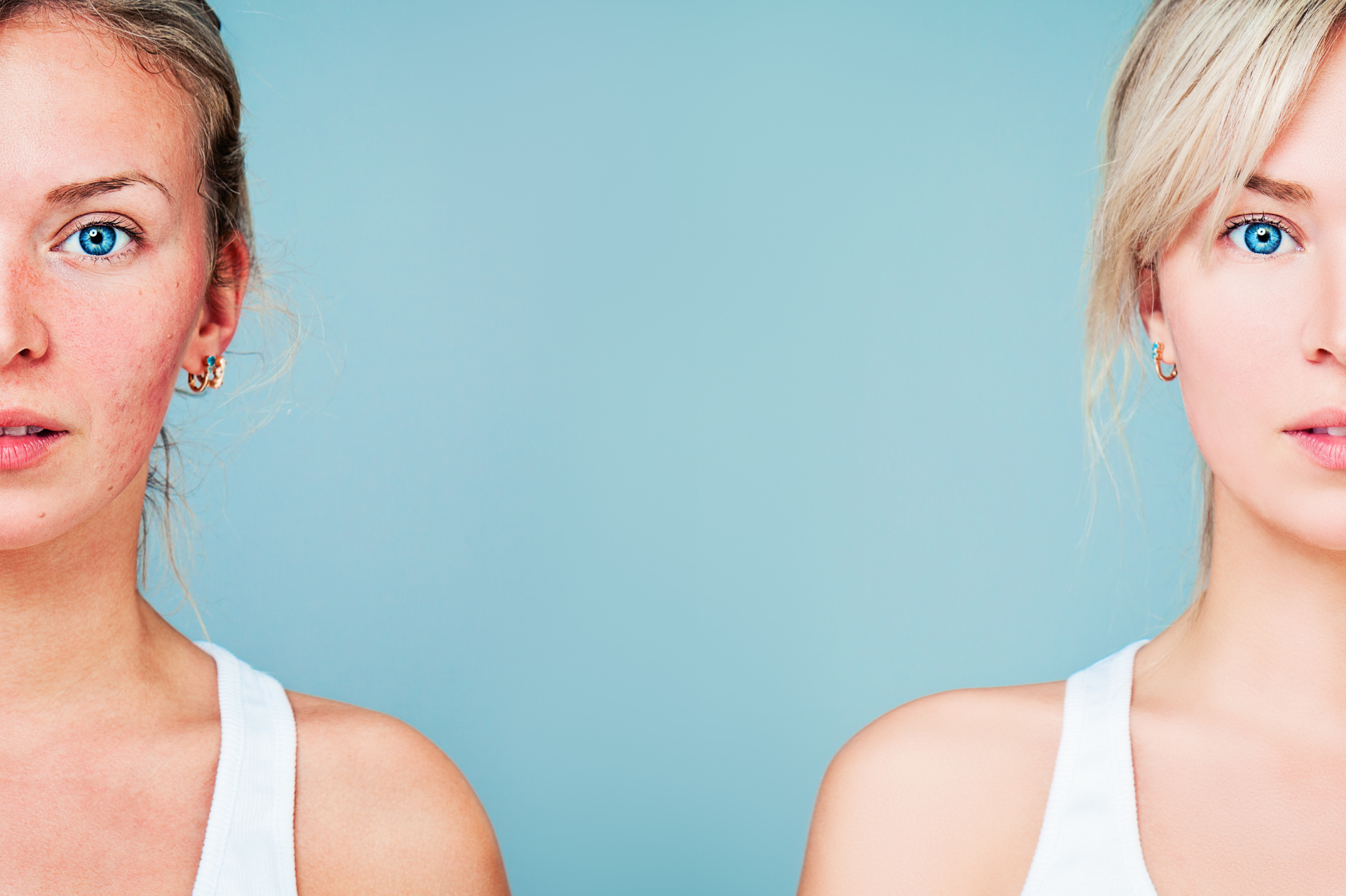 Five signs your body isn't detoxifying as it should